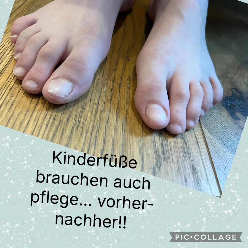 Fußpflege Vorher-Nachher 1
