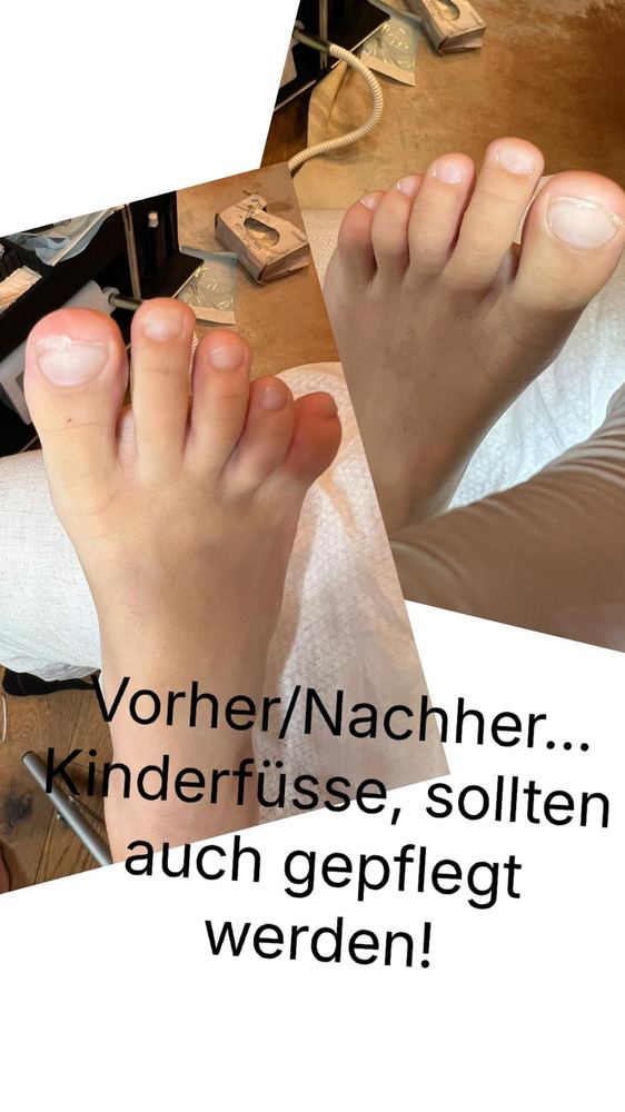 Fußpflege Vorher-Nachher 2